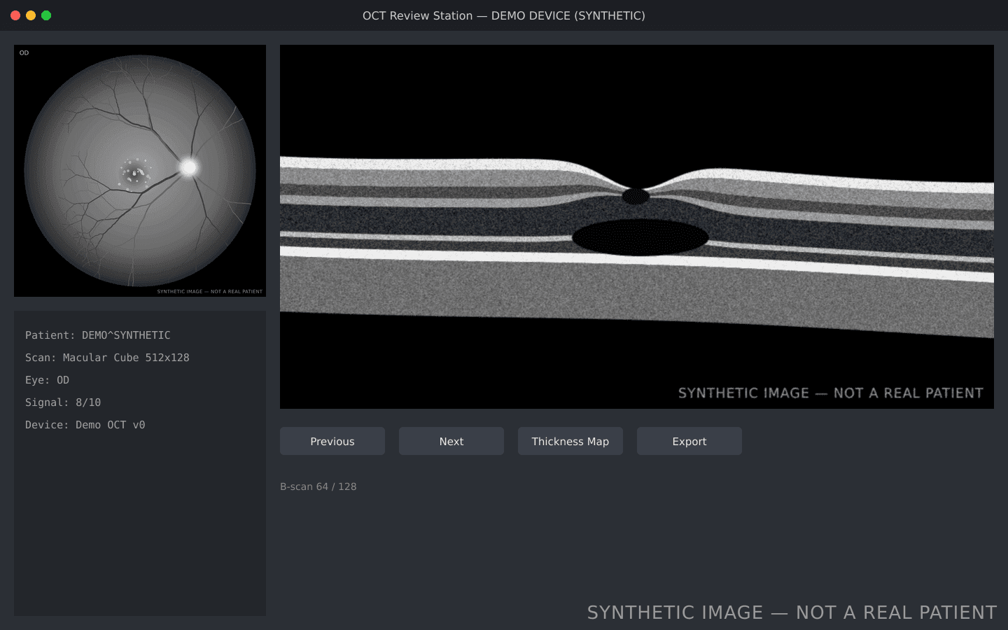 Synthetic OCT review workstation screen with a macular scan